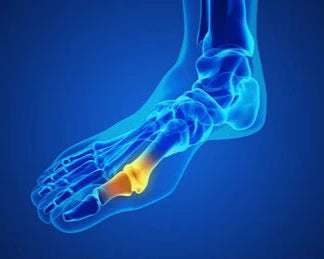 Gout Support Millet packs