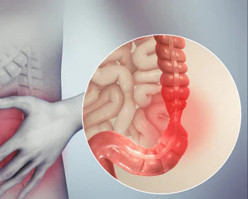 Irrestibile Bowel Syndrome (IBS) Support Millet packs